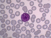 Blood Image of Basophils,a rare type of white cell